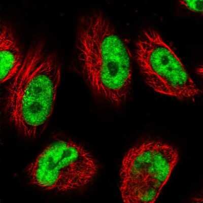 Immunocytochemistry/Immunofluorescence: USP22 Antibody [NBP1-82941] - Staining of human cell line U-251 MG shows localization to nuclear speckles. Antibody staining is shown in green.