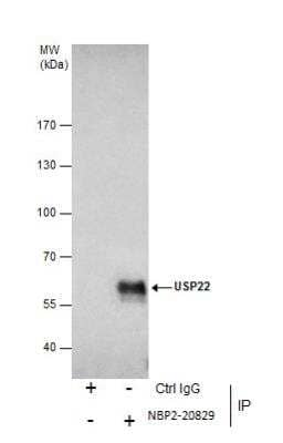 Immunoprecipitation: USP22 Antibody [NBP2-20829] - Immunoprecipitation of USP22 protein from A549 whole cell extracts using 5 ug of USP22 antibody [N3C3]. Western blot analysis was performed using USP22 antibody [N3C3]. EasyBlot anti-Rabbit IgG was used as a secondary reagent.