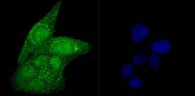 Immunocytochemistry/Immunofluorescence: USP22 Antibody (JU63-27) [NBP2-75702] - Staining USP22 in Hela cells (green). The nuclear counter stain is DAPI (blue). Cells were fixed in paraformaldehyde, permeabilised with 0.25% Triton X100/PBS.
