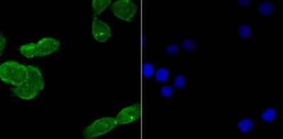 Immunocytochemistry/Immunofluorescence: USP22 Antibody (JU63-27) [NBP2-75702] - Staining USP22 in LOVO cells (green). The nuclear counter stain is DAPI (blue). Cells were fixed in paraformaldehyde, permeabilised with 0.25% Triton X100/PBS.