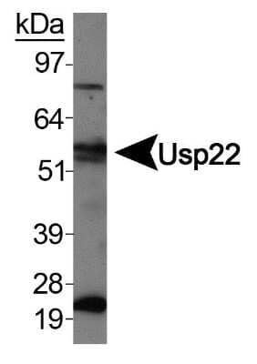 Western Blot: USP22 Antibody [NBP1-49644] - Western  blot analysis of Usp22 in HeLa whole cell extracts.