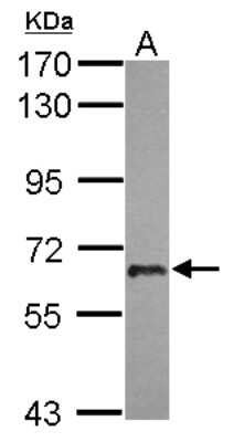 Western Blot: USP22 Antibody [NBP2-20829] - Sample (30 ug of whole cell lysate) A: A549 7. 5% SDS PAGE gel, diluted at 1:1000.