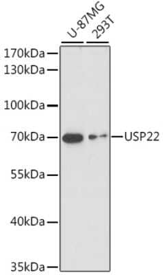 Western Blot: USP22 Antibody [NBP2-94099] - Analysis of extracts of various cell lines, using USP22 at 1:1000 dilution. Secondary antibody: HRP Goat Anti-Rabbit IgG (H+L) at 1:10000 dilution. Lysates/proteins: 25ug per lane. Blocking buffer: 3% nonfat dry milk in TBST. Detection: ECL Basic Kit . Exposure time: 30s.