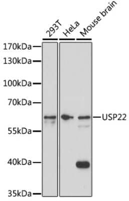 Western Blot: USP22 Antibody [NBP2-94320] - Analysis of extracts of various cell lines, using USP22 at 1:1000 dilution. Secondary antibody: HRP Goat Anti-Rabbit IgG (H+L) at 1:10000 dilution. Lysates/proteins: 25ug per lane. Blocking buffer: 3% nonfat dry milk in TBST. Detection: ECL Basic Kit . Exposure time: 5min.