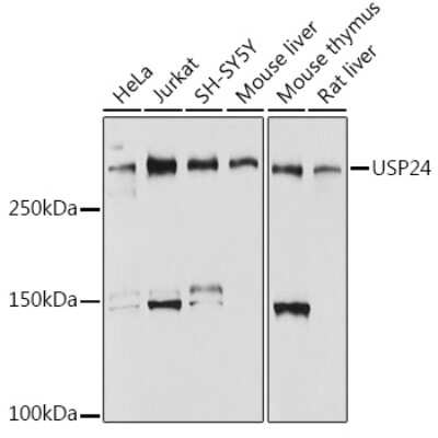 Western Blot: USP24 Antibody (7K7N2) [NBP3-15286] - Western blot analysis of extracts of various cell lines, using USP24 antibody (NBP3-15286) at 1:1000 dilution. Secondary antibody: HRP Goat Anti-Rabbit IgG (H+L) at 1:10000 dilution. Lysates/proteins: 25ug per lane. Blocking buffer: 3% nonfat dry milk in TBST. Detection: ECL Basic Kit. Exposure time: 1s.