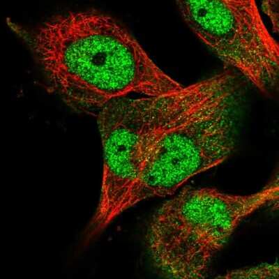 Immunocytochemistry/Immunofluorescence: USP24 Antibody [NBP2-57858] - Staining of human cell line U-251 MG shows localization to nucleoplasm & cytosol.