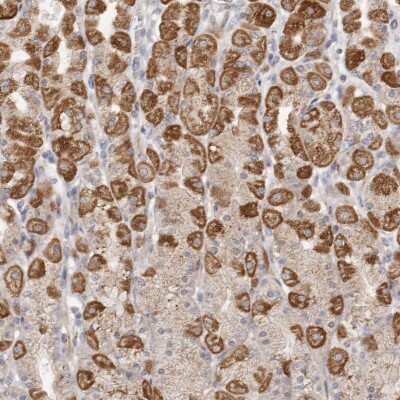 Immunohistochemistry-Paraffin USP24 Antibody