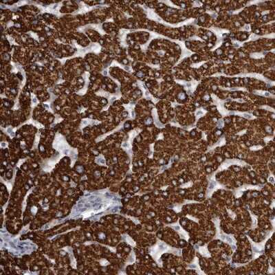 Immunohistochemistry-Paraffin: USP24 Antibody [NBP1-82943] - Staining of human liver shows strong cytoplasmic positivity in hepatocytes.