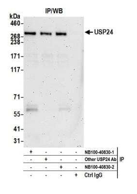 Immunoprecipitation: USP24 Antibody [NB100-40830] - Detection of human USP24 by western blot of immunoprecipitates. Samples: Whole cell lysate (1.0 mg per IP reaction; 20% of IP loaded) from HeLa and cells prepared using NETN lysis buffer. Antibodies: Affinity purified rabbit anti-USP24 antibody NB100-40830 (lot 2) used for IP at 3 ug per reaction. USP24 was also immunoprecipitated by a previous lot of this antibody (lot 1) and a rabbit anti-USP24 antibody from Company B. For blotting immunoprecipitated USP24, NB100-40830 was used at 1 ug/ml. Detection: Chemiluminescence with an exposure time of 3 minutes.