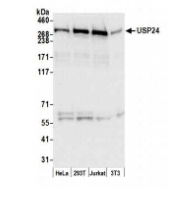 Western Blot USP24 Antibody