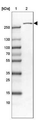 Western Blot USP24 Antibody