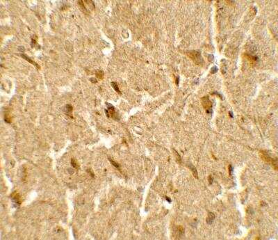 Immunohistochemistry: USP25 Antibody [NBP2-82051] - Immunohistochemistry of USP25 in human brain tissue with USP25 antibody at 5 ug/mL.