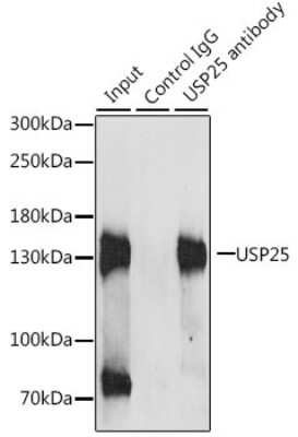 Western Blot: USP25 Antibody [NBP2-93685] - Analysis of 200ug extracts of HeLa cells, using USP25 at a dilition of 1:1000.