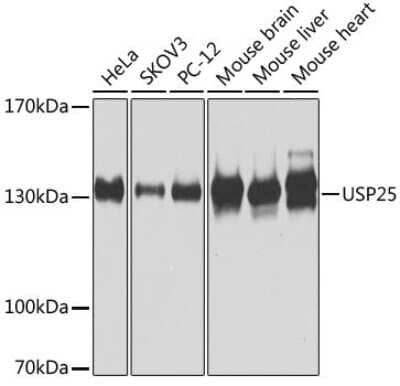 Western Blot: USP25 Antibody [NBP2-93685] - Analysis of extracts of various cell lines, using USP25 at 1:1000 dilution. Secondary antibody: HRP Goat Anti-Rabbit IgG (H+L) at 1:10000 dilution. Lysates/proteins: 25ug per lane. Blocking buffer: 3% nonfat dry milk in TBST. Detection: ECL Basic Kit . Exposure time: 60s.