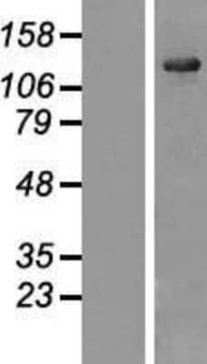 Western Blot: USP25 Overexpression Lysate (Adult Normal) [NBL1-17654] Left-Empty vector transfected control cell lysate (HEK293 cell lysate); Right -Over-expression Lysate for USP25.