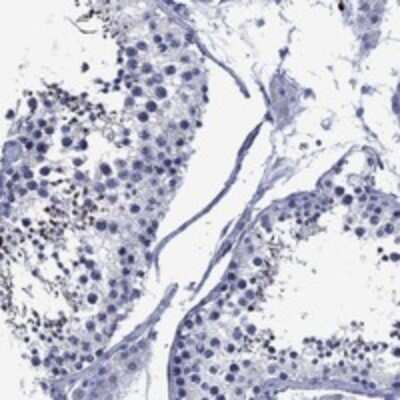 Immunohistochemistry-Paraffin USP26 Antibody