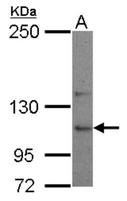 Western Blot USP26 Antibody