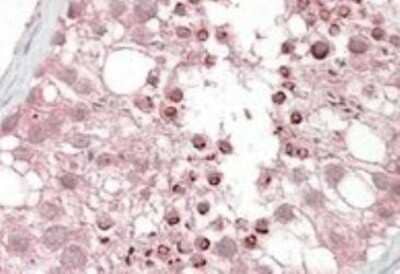 Immunohistochemistry-Paraffin: USP28 Antibody [NB100-96911] - 3.8ug/ml staining of Human Testis. Steamed antigen retrieval with citrate buffer pH 6, AP-staining.