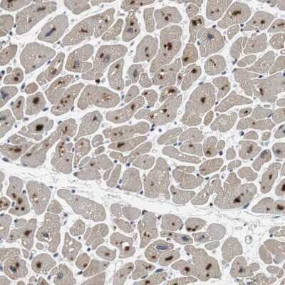 Immunohistochemistry-Paraffin: USP28 Antibody [NBP1-82904] - Staining of human heart muscle shows strong nuclear positivity in cardiomyocytes.