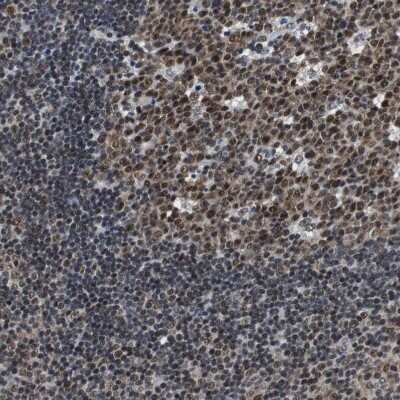 Immunohistochemistry-Paraffin: USP28 Antibody [NBP1-82904] - Staining of human lymph node shows strong nuclear positivity in germinal center cells.