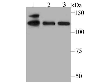 Western Blot: USP28 Antibody [NBP2-76973] - Western blot analysis of USP28 on different cell lysates using anti-USP28 antibody at 1/500 dilution.Positive control:Lane1: K562Lane2: A549Lane3: Daudi