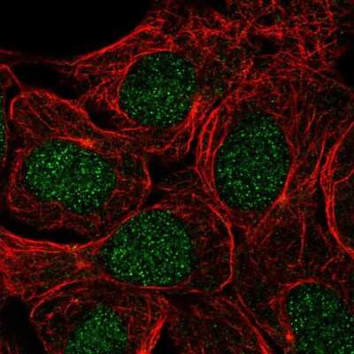 Immunocytochemistry/Immunofluorescence: USP3 Antibody [NBP2-56600] - Staining of human cell line RT4 shows localization to nucleus.