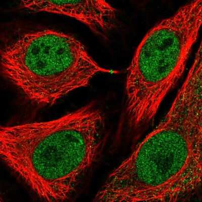 Immunocytochemistry/Immunofluorescence: USP3 Antibody [NBP2-58394] - Staining of human cell line HeLa shows localization to nucleoplasm & midbody ring.