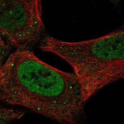 Immunocytochemistry/Immunofluorescence: USP3 Antibody [NBP2-69056] - Staining of human cell line U-2 OS shows localization to nucleoplasm & cytoplasmic bodies.