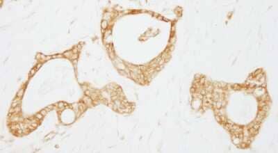 Immunohistochemistry-Paraffin USP3 Antibody