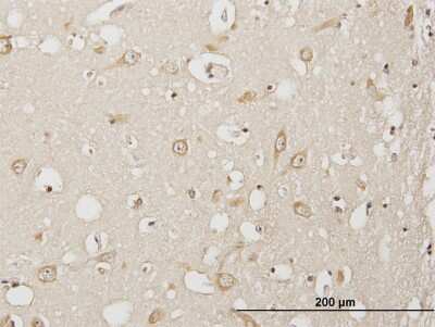 Immunohistochemistry-Paraffin: USP3 Antibody [H00009960-B01P] - Analysis of purified antibody to USP3 on formalin-fixed paraffin-embedded human cerebral cortex. (antibody concentration 3 ug/ml)