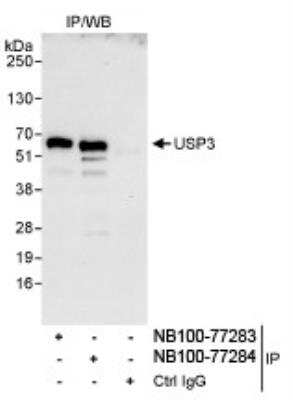 Immunoprecipitation: USP3 Antibody [NB100-77283] - Detection of Human USP3 by Western Blot of  Immunoprecipitates. Samples: Whole cell lysate (1 mg for IP,  20% of IP loaded) from HeLa cells. Antibodies: Affinity purified  rabbit anti-USP3 antibody NB100-77283 used for IP at 3 mcg/mg  lysate. USP3 was also immunoprecipitated by rabbit anti-USP3  antibody NB100-77284, which recognizes a downstream epitope.  Detection: Chemiluminescence  with an exposure time of 10 seconds.