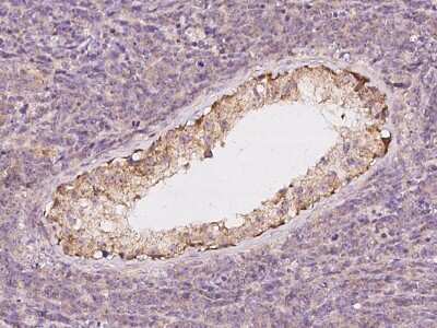 Immunohistochemistry-Paraffin USP32 Antibody