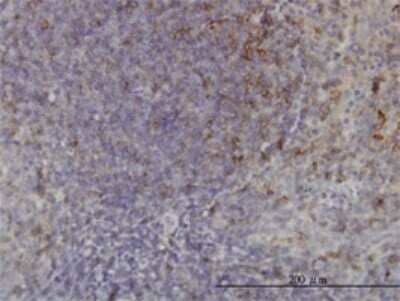 Immunohistochemistry-Paraffin: USP33 Antibody (5B5) [H00023032-M01] - Analysis of monoclonal antibody to USP33 on formalin-fixed paraffin-embedded human tonsil. Antibody concentration 3 ug/ml.