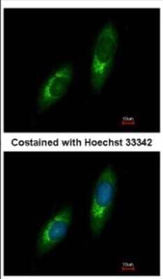 Immunocytochemistry/Immunofluorescence: USP33 Antibody [NBP2-20832] - Immunofluorescence analysis of methanol-fixed HeLa, using antibody at 1:200 dilution.