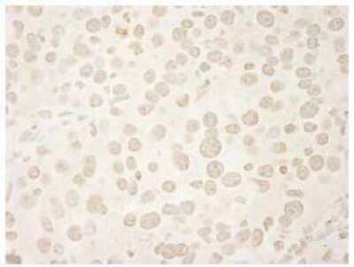 Immunohistochemistry-Paraffin: USP33 Antibody [NB110-40693] - FFPE section of mouse renal cell carcinoma.  Affinity purified rabbit anti-USP33 used at a dilution of 1:250.