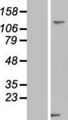 Western Blot: USP33 Overexpression Lysate (Adult Normal) [NBP2-07230] Left-Empty vector transfected control cell lysate (HEK293 cell lysate); Right -Over-expression Lysate for USP33.