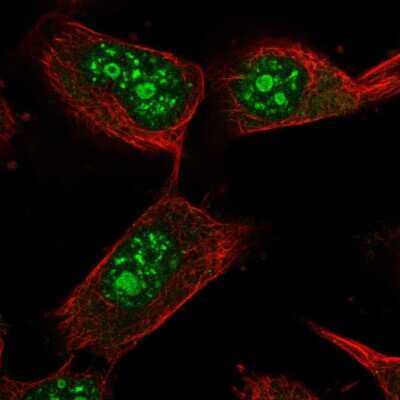 Immunocytochemistry/Immunofluorescence: USP36 Antibody [NBP2-55536] - Staining of human cell line U-251 MG shows localization to nucleoli & nuclear speckles.