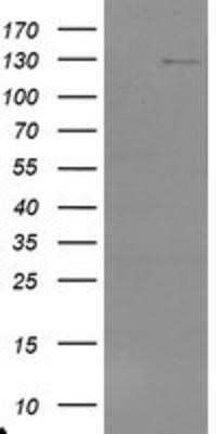 Western Blot: USP36 Antibody (OTI7G3) - Azide and BSA Free [NBP2-74806] - HEK293T cells were transfected with the pCMV6-ENTRY control (Left lane) or pCMV6-ENTRY USP36 (Right lane) cDNA for 48 hrs and lysed. Equivalent amounts of cell lysates (5 ug per lane) were separated by SDS-PAGE and immunoblotted with anti-USP36.