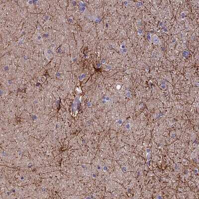 Immunohistochemistry-Paraffin: USP37 Antibody [NBP1-82901] - Staining of human hippocampus shows distinct cytoplasmic positivity in astrocytes.