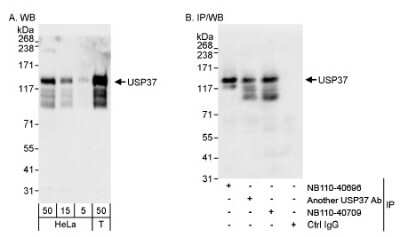 Western Blot: USP37 Antibody [NB110-40709] - Detection of Human USP37 on HeLa whole cell lysate using NB110-40709. USP37 was also immunoprecipitated by rabbit anti-USP37 antibody NB110-40696.