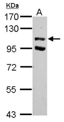 Western Blot: USP37 Antibody [NBP2-20833] - Sample (30 ug of whole cell lysate) A: 293T 7. 5% SDS PAGE gel, diluted at 1:1000.