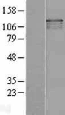 Western Blot: USP37 Overexpression Lysate (Adult Normal) [NBL1-17660] Left-Empty vector transfected control cell lysate (HEK293 cell lysate); Right -Over-expression Lysate for USP37.
