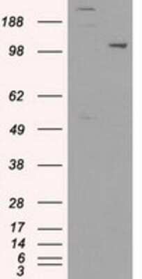 Western Blot: USP38 Antibody (1D11) [NBP1-48049] - HEK293T cells were transfected with the pCMV6-ENTRY control (Left lane) or pCMV6-ENTRY USP38 (Right lane) cDNA for 48 hrs and lysed. Equivalent amounts of cell lysates (5 ug per lane) were separated by SDS-PAGE and immunoblotted with anti-USP38.