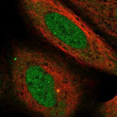 Immunocytochemistry/Immunofluorescence: USP38 Antibody [NBP2-58097] - Staining of human cell line U-2 OS shows localization to nucleoplasm, cytosol & centrosome.