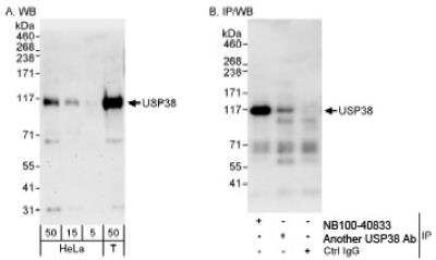 Western Blot: USP38 Antibody [NB100-40833] - Detection of Human USP38 on HeLa whole cell lysate using NB100-40833. USP38 was also immunoprecipitated by another rabbit anti-USP38 antibody.