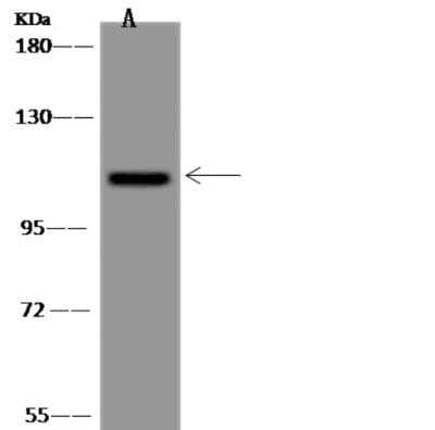 Western Blot: USP38 Antibody [NBP3-06481] - Lane A: Hela Whole Cell LysateLysates/proteins at 30 ug per lane.SecondaryGoat Anti-Rabbit IgG (H+L)/HRP at 1/10000 dilution.Developed using the ECL technique.Performed under reducing conditions.Predicted band size:117 kDa
