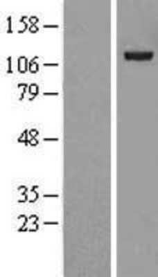 Western Blot: USP38 Overexpression Lysate (Adult Normal) [NBL1-17661] Left-Empty vector transfected control cell lysate (HEK293 cell lysate); Right -Over-expression Lysate for USP38.