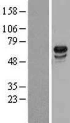 Western Blot: USP39 Overexpression Lysate (Adult Normal) [NBL1-17662] Left-Empty vector transfected control cell lysate (HEK293 cell lysate); Right -Over-expression Lysate for USP39.