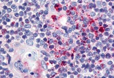 Immunohistochemistry-Paraffin: USP4 Antibody [NB100-90597] - Anti-USP4 antibody IHC of human thymus. Immunohistochemistry of formalin-fixed, paraffin-embedded tissue after heat-induced antigen retrieval.