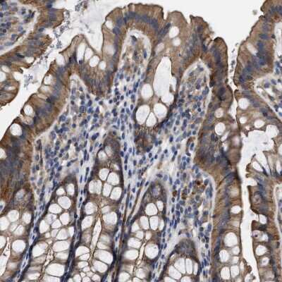 Immunohistochemistry-Paraffin: USP4 Antibody [NBP1-86876] - Staining of human rectum shows moderate cytoplasmic positivity in glandular cells.